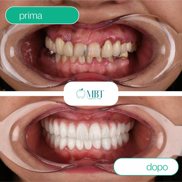 Slider image (4) MBT Dental Pro